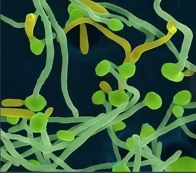 金黄色葡萄球菌的微生物特性,金黄色葡萄球菌的培养特性