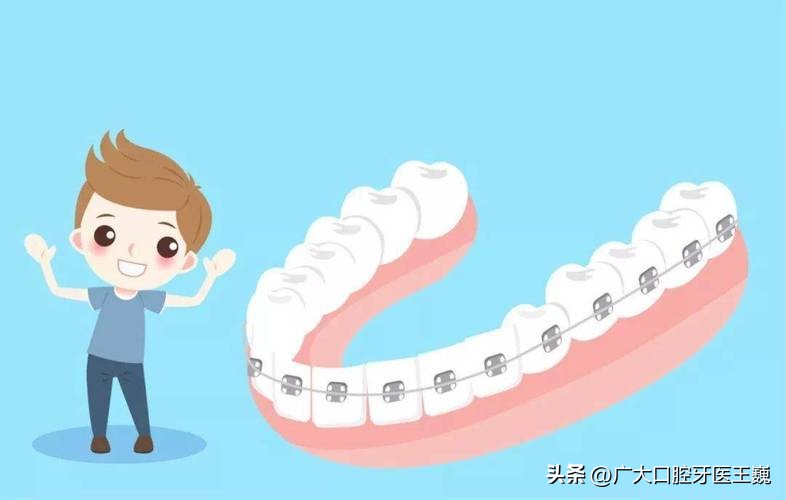 牙齿正畸矫正一般需要多久,正畸科普牙齿矫正的年龄限制问题