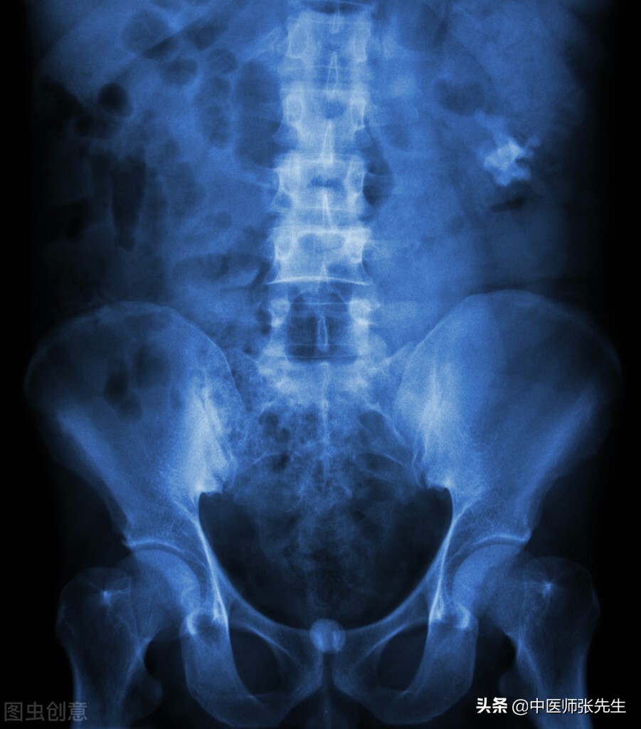 中医说结石是什么原因造成的,中医认为结石是什么原因引起的