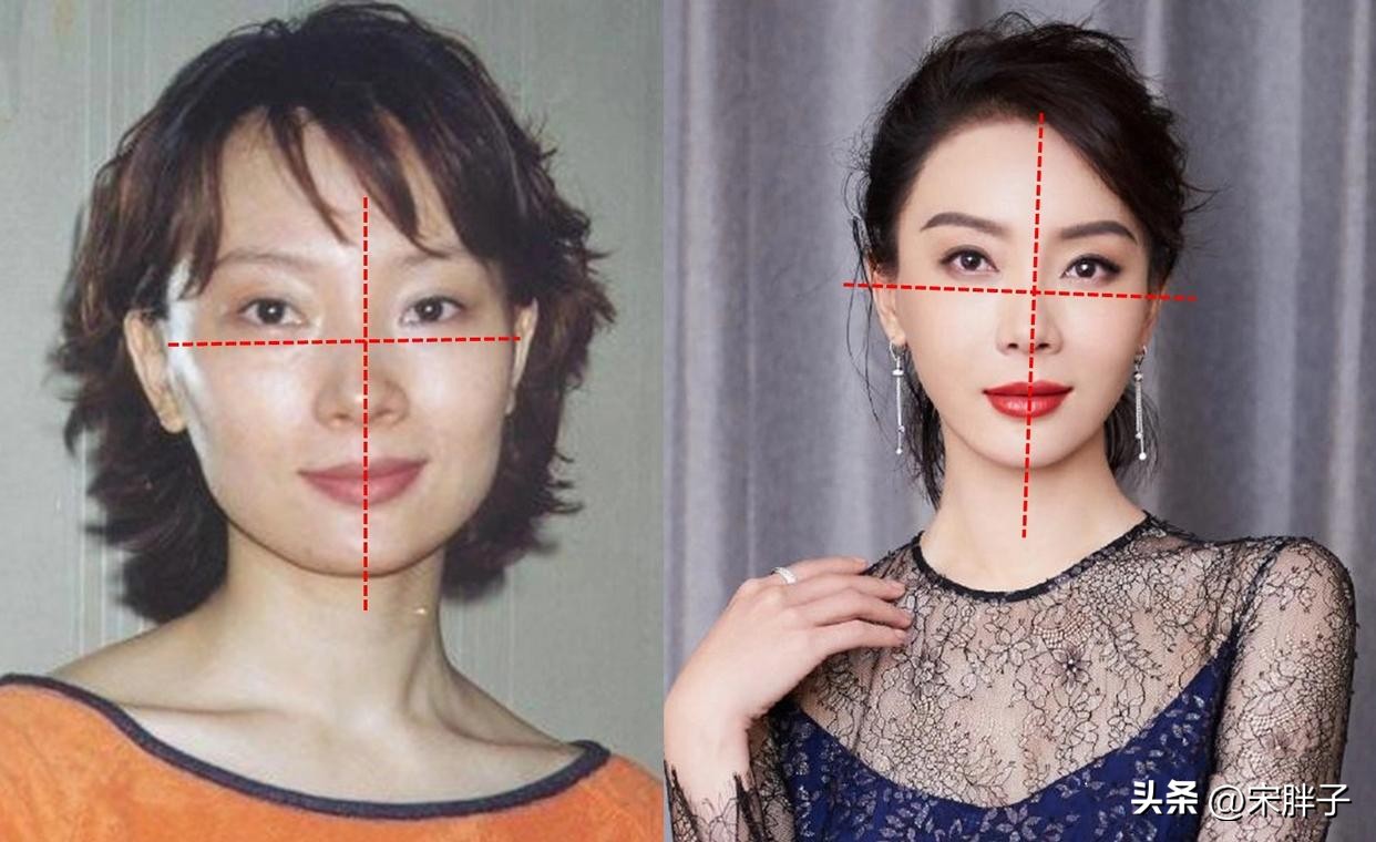 整容后遗症凸显,陈数或成为下一个“蔡明”!