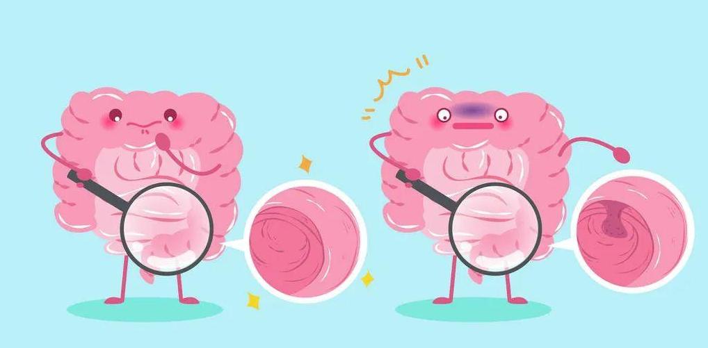 化痰散结，这几味虫类药材，助你“吃掉”肠息肉