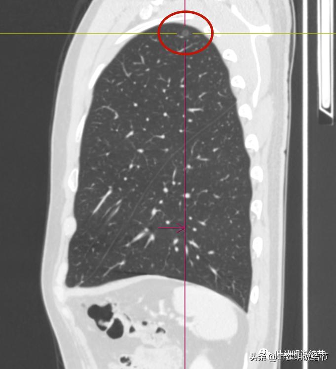 医生为了预防医患矛盾过度诊疗,医院过度医疗手术