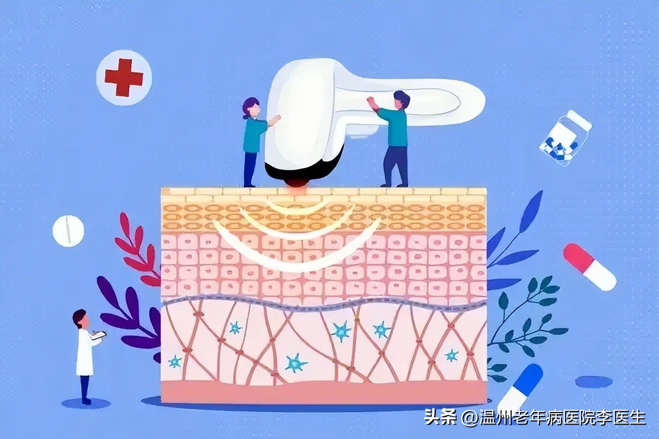 淡斑超光子,美白嫩肤光子