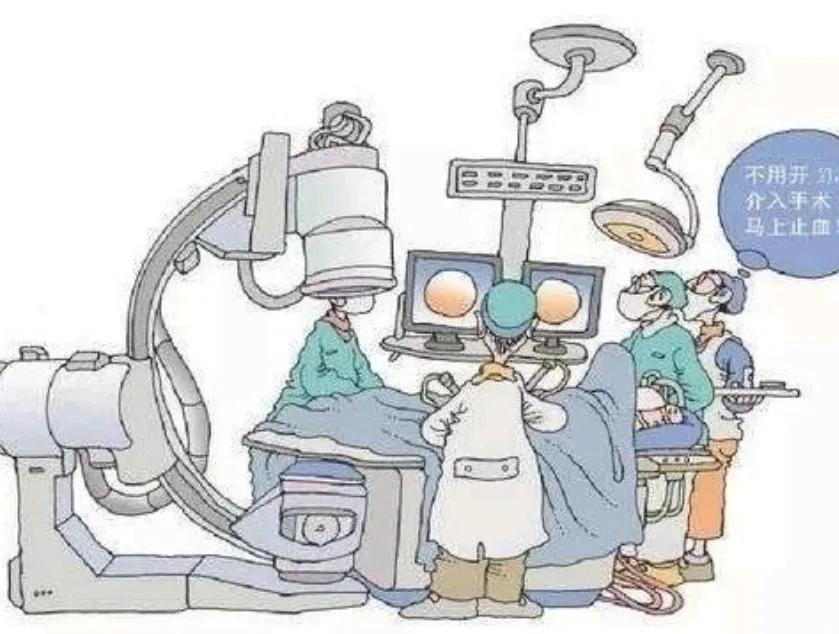 鼻出血介入治疗,鼻出血快速止血