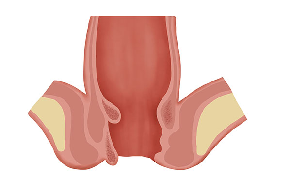 3种比10级生产还疼的手术，经历过的都是勇士