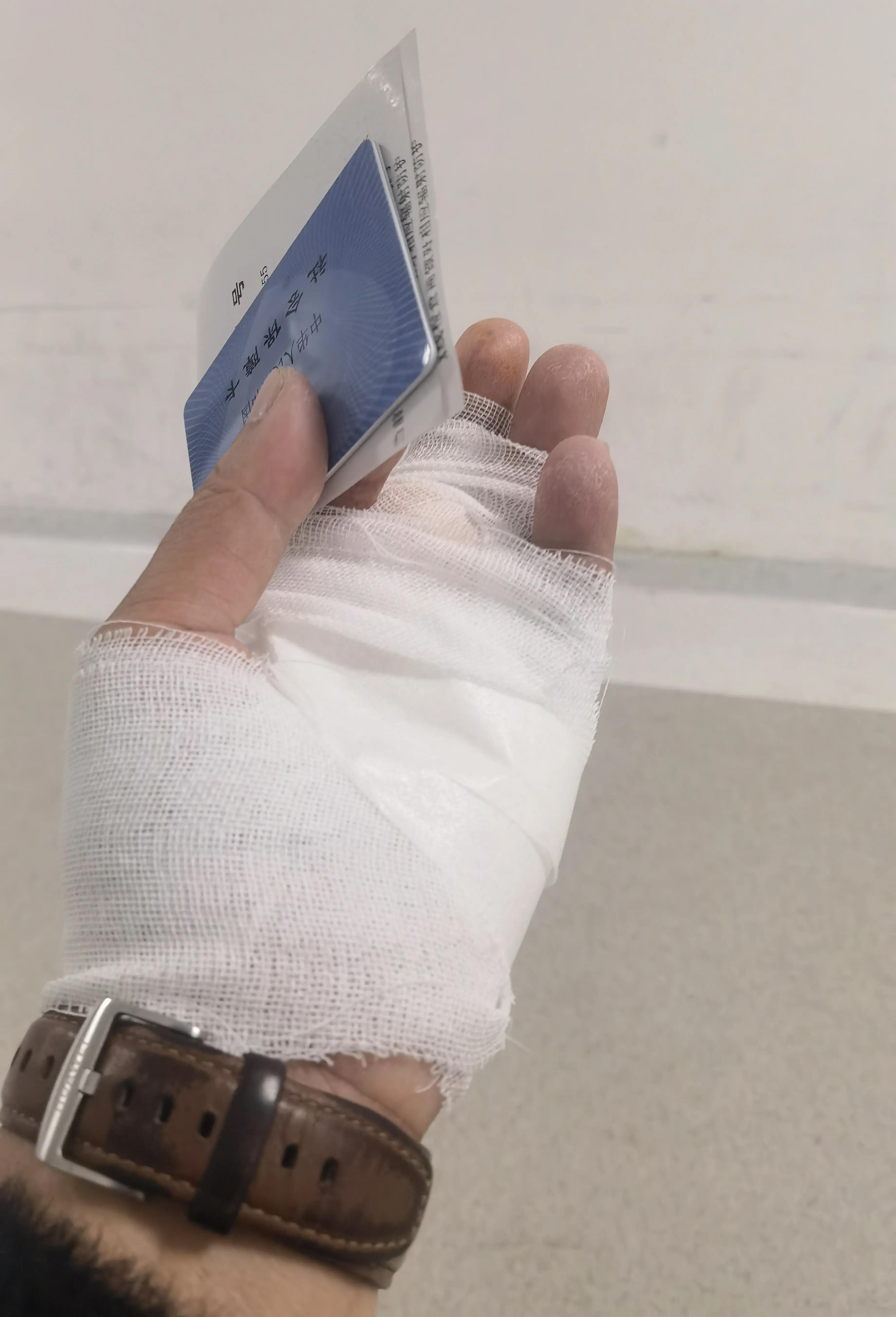 被野猫抓伤破皮要不要打针,被野猫抓伤后打疫苗多少钱