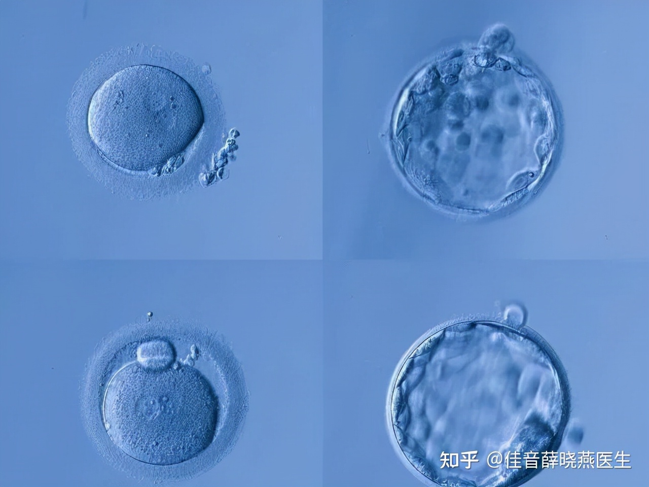 冻胚移植前孕酮和内膜多少正常,移植冻胚月经第十天内膜1.0