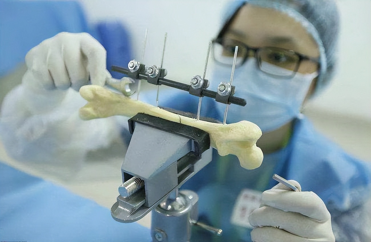 骨盆趾骨骨折后最佳的物理疗法,骨科创伤的救治