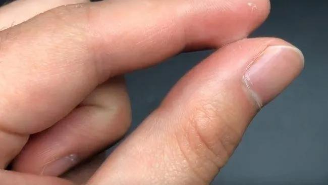 花露水和风油精的隐藏小妙招,风油精和花露水混合妙用