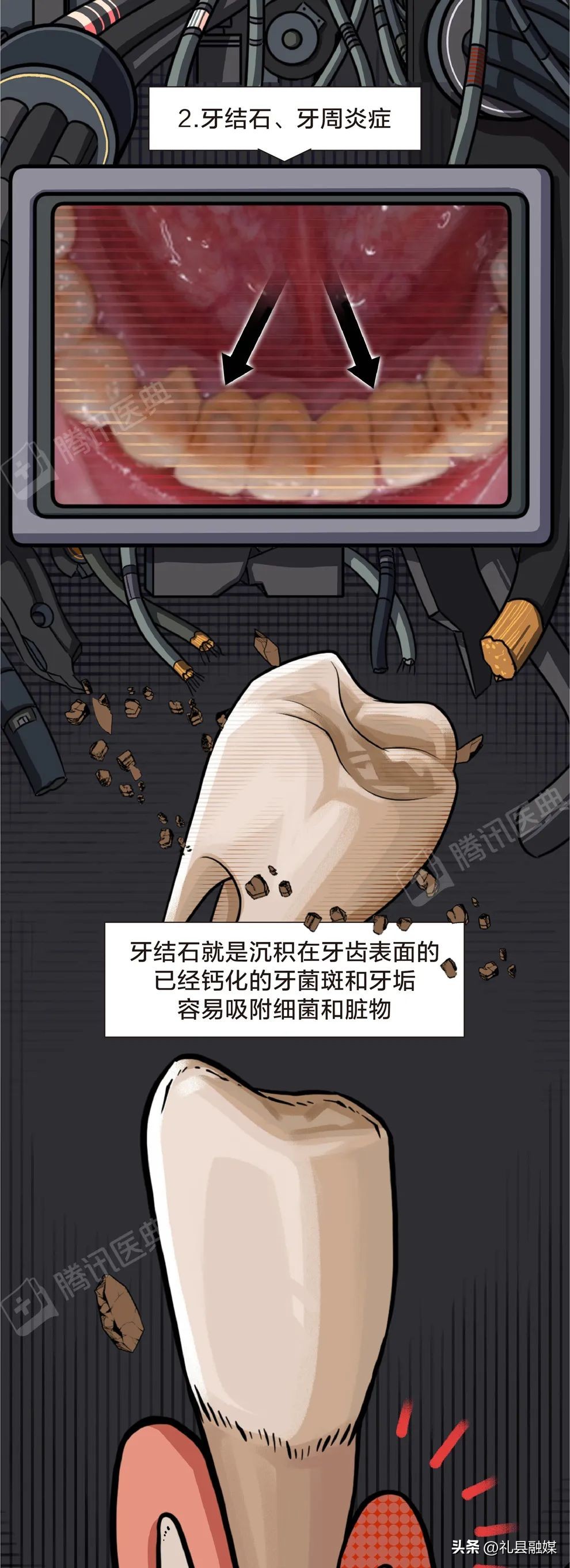 牙缝隙大吃菜就塞牙怎么修复,牙齿吃菜老塞牙怎么办