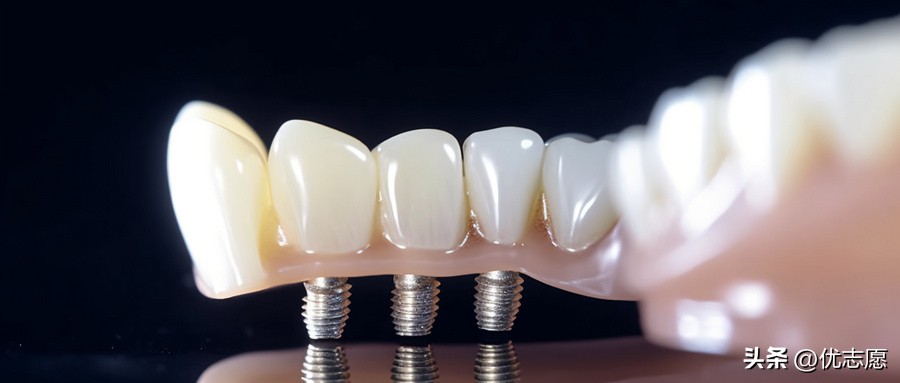 食品营养与健康专科专业就业前景,专科电气自动化技术专业就业前景