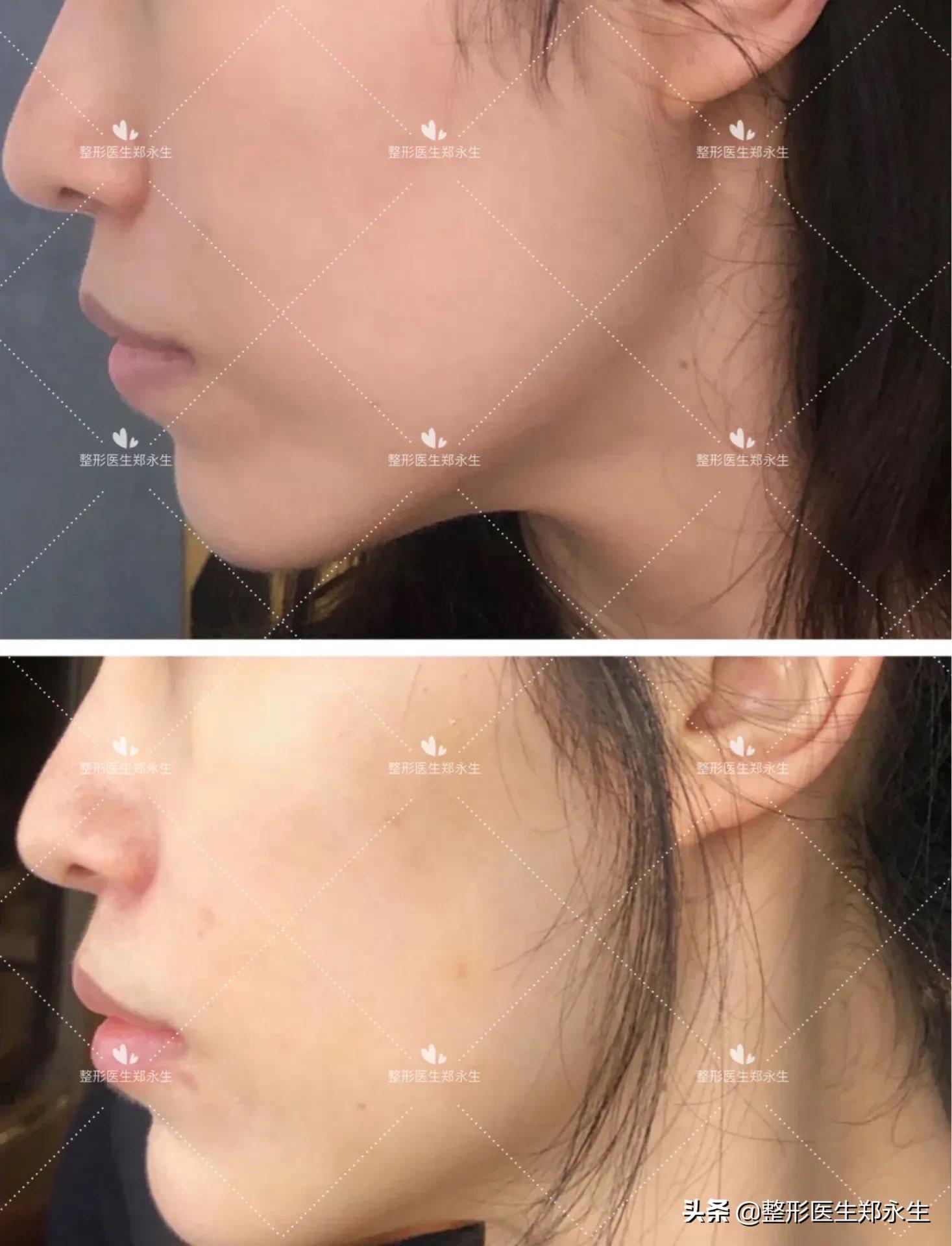 干裂起皮、涂口红不好看,可能是你的嘴唇变老了!唇部老化怎么办