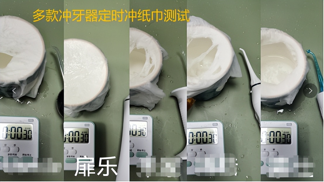 水牙线冲牙器推荐吗,冲牙器牙线哪个好用