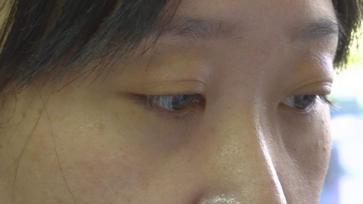 张宏：“医”路芳华不忘初心