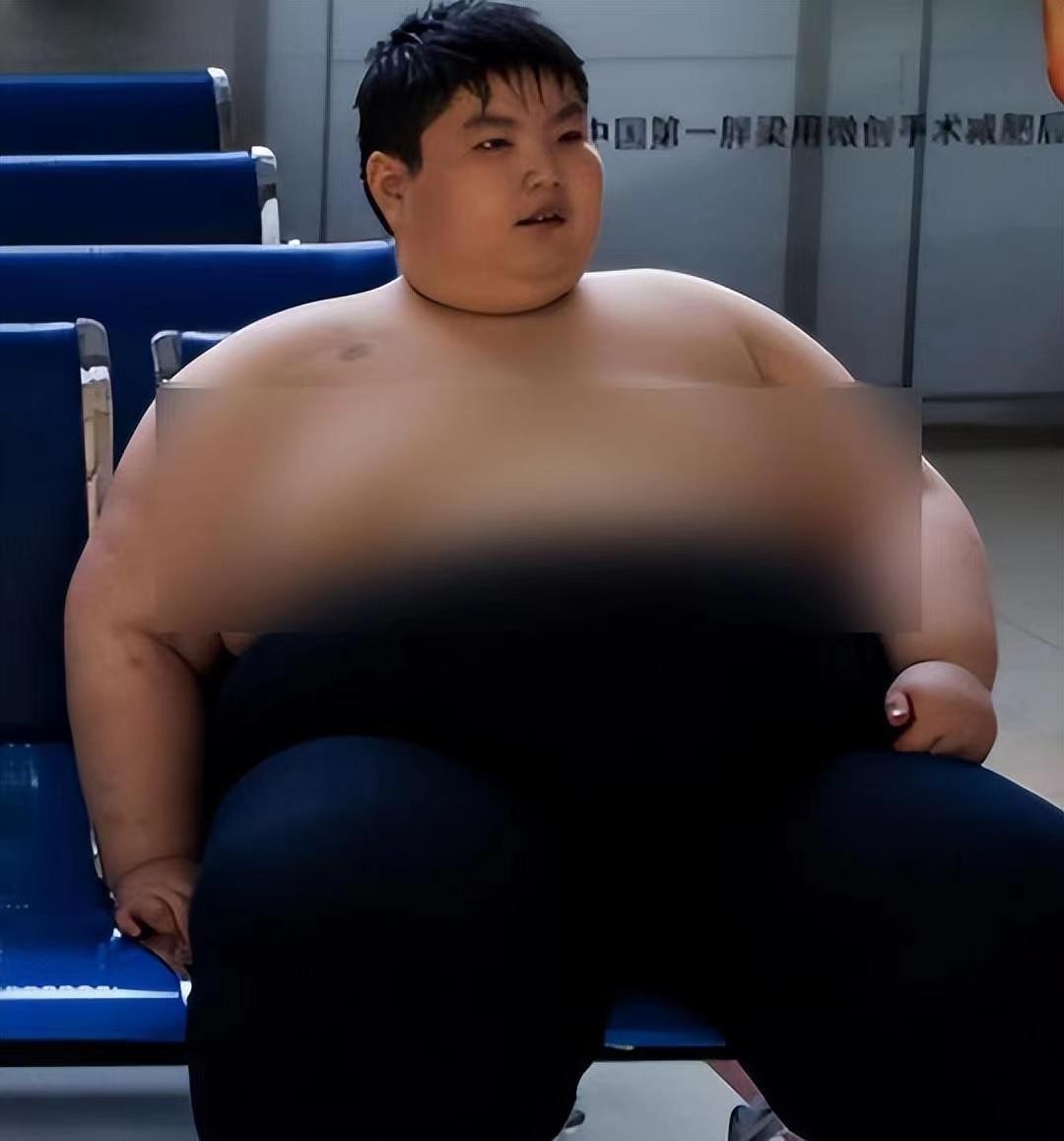 江西一男孩14岁达到300斤,10岁男孩一顿吃三碗体重飙到130斤