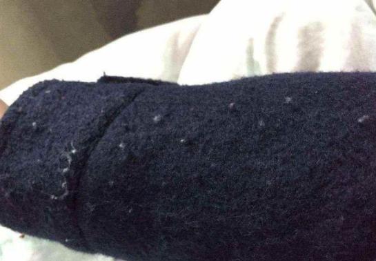 黑色衣服粘毛怎么处理小技巧,衣服粘毛小技巧