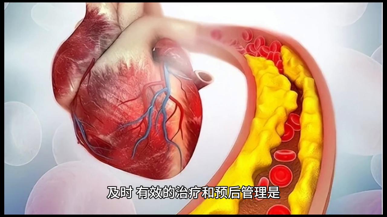 卒中治疗与预后：全面策略，重拾健康生活#卒中防控立即行动