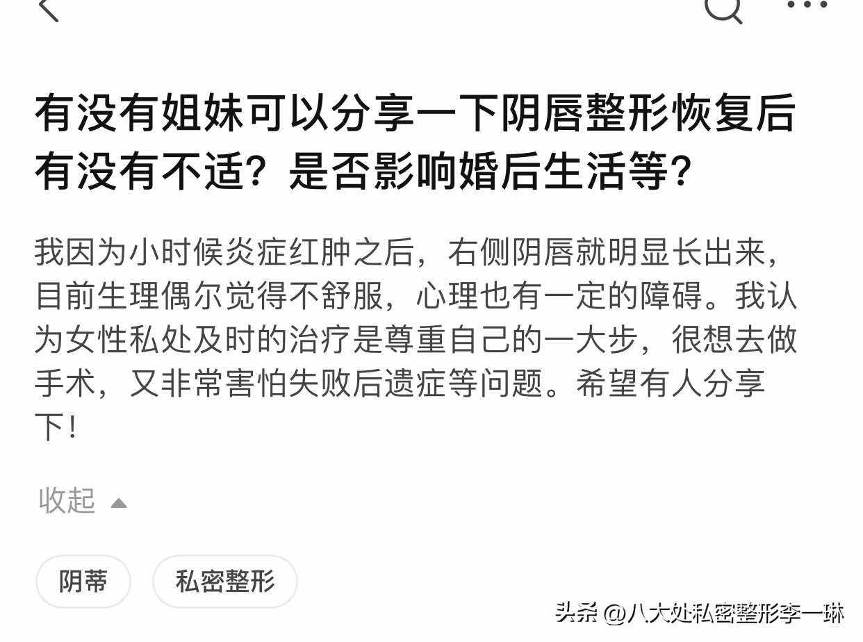 知乎问答:小阴唇整形术后有哪些不适?是否影响婚姻和生育?