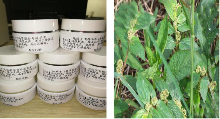 天热湿疹痒痒痒？中医治疗退！退！退！