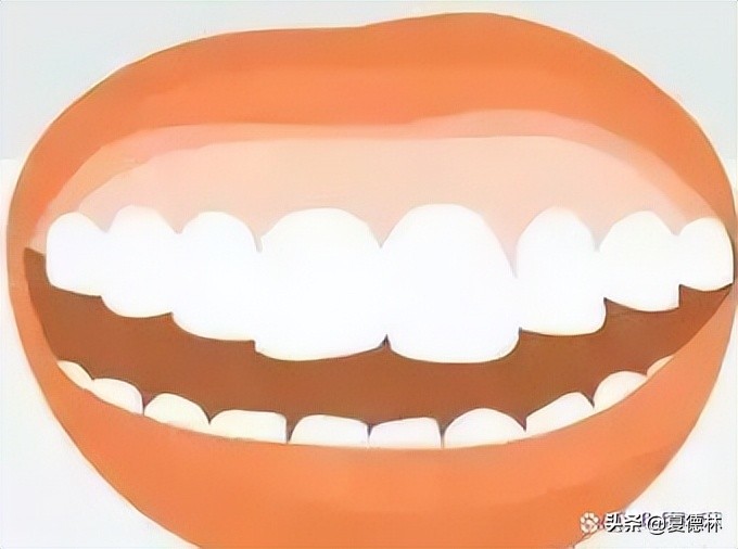 笑起来露牙龈的很难看怎么改善,笑起来不好看露牙龈怎么办