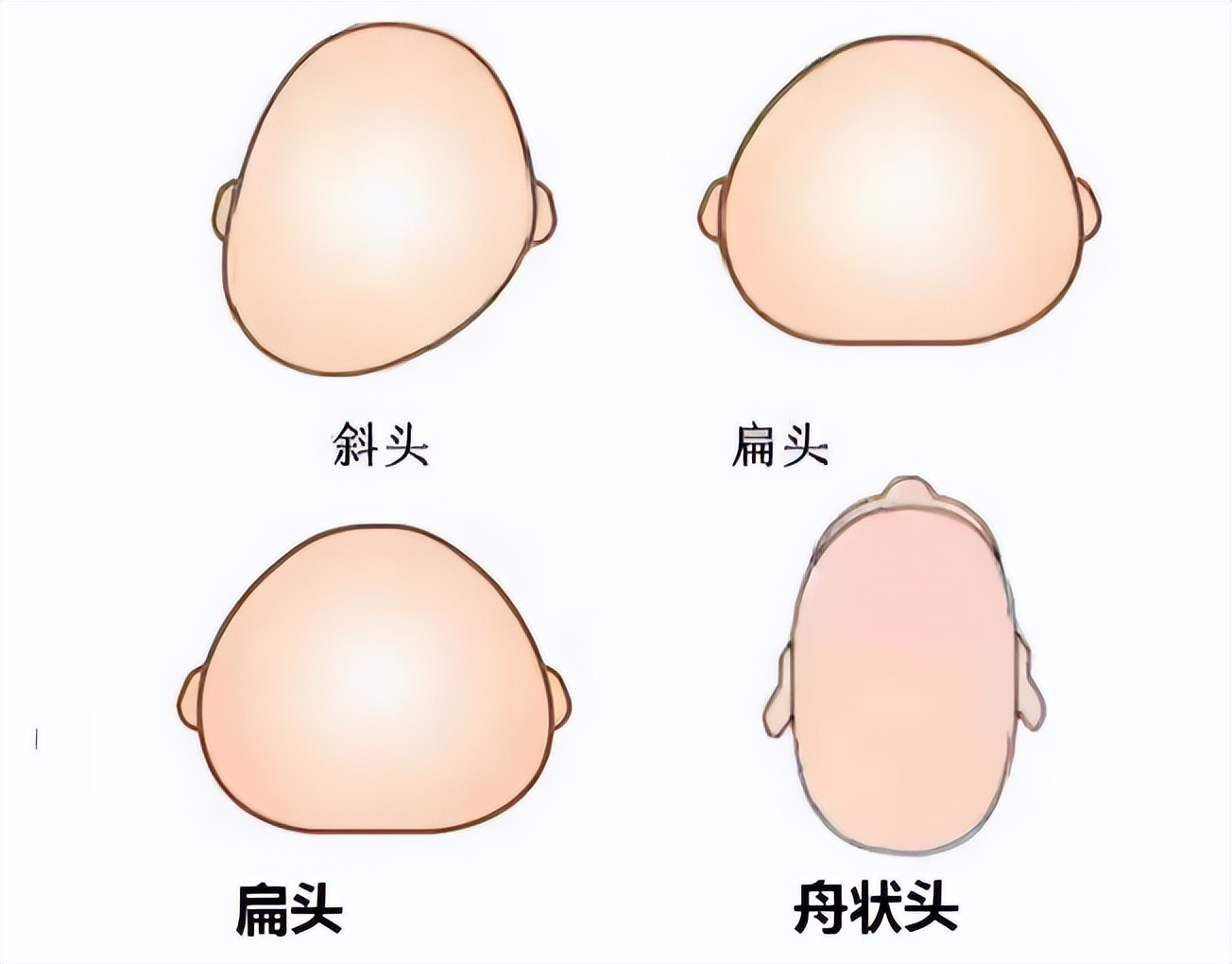 婴儿视觉发育最佳方法,婴儿头几个月发育最好