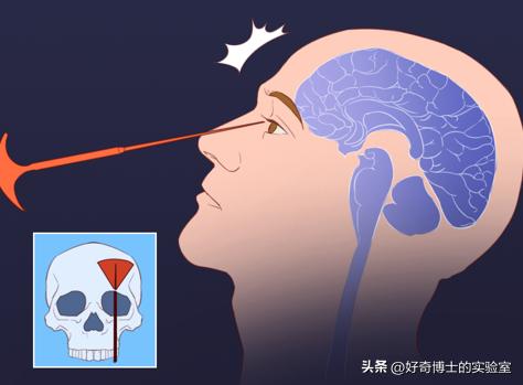 人类十大精神病有哪些,人类治疗精神病的10种离谱手法