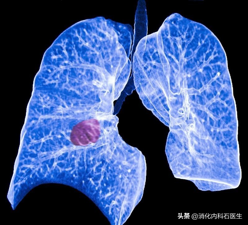 农民工头痛，按脑炎治疗无效，主任查房大怒：这个地方为啥没摸？