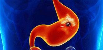 胃不舒服胃酸应该怎么办,胃不舒服胃酸怎么缓解