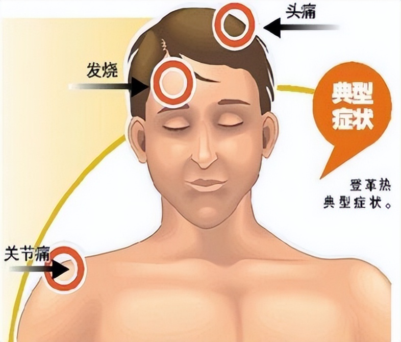 预防控制登革热最佳的措施是灭蚊,登革热的症状及预防措施