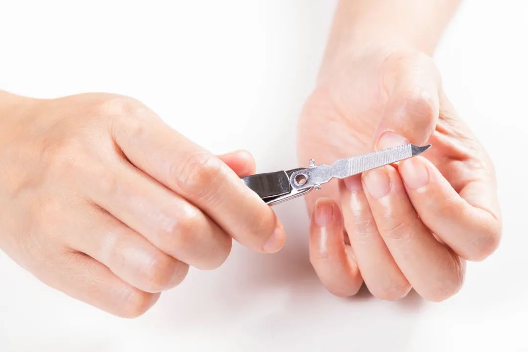 指甲盖出现横纹是什么病,指甲盖上起竖纹白斑是死亡信号