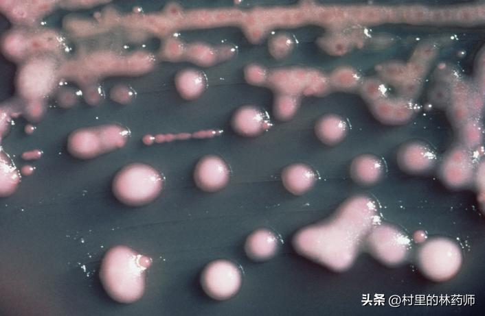 肺炎痊愈了痰液里体内还有细菌吗,能不能从痰液上判断出是哪种细菌