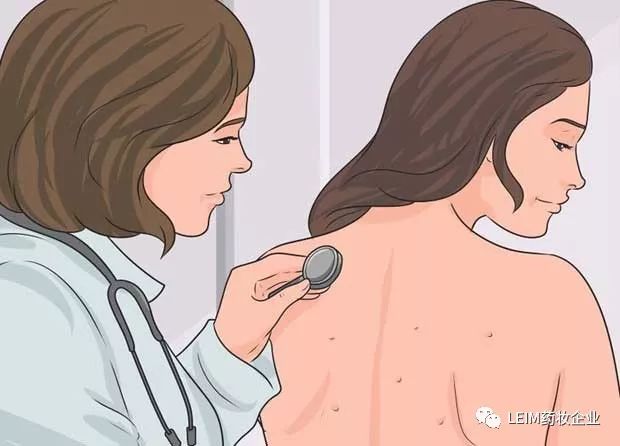 痘痘和痘印如何去掉,祛后背痘痘和痘印