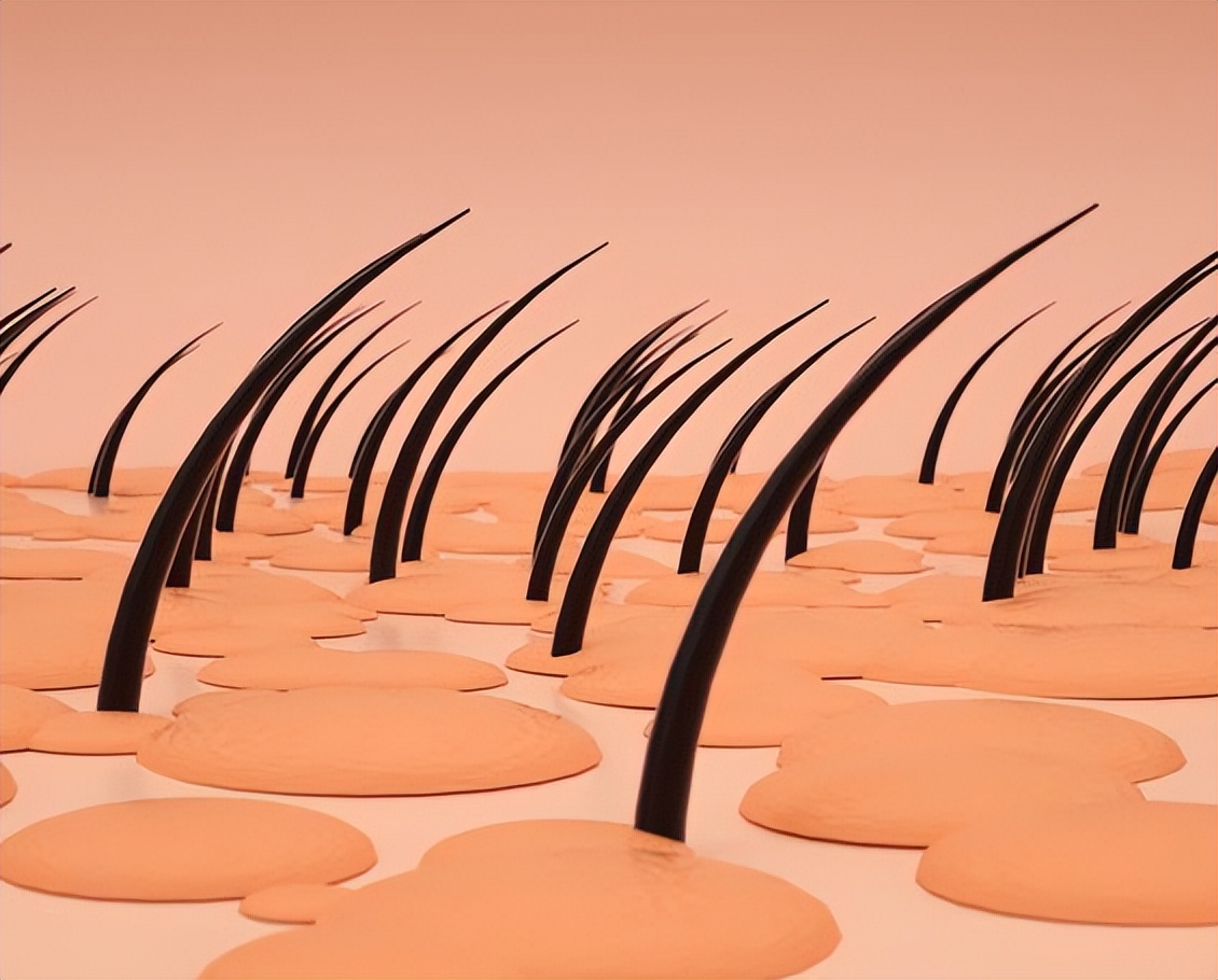 头皮上经常长疙瘩和脓包是怎么了,头皮上有脓疙瘩是怎么回事