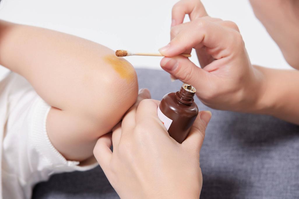 仓鼠咬人全身皮肤变成火龙果事件,杭州一女子买仓鼠得恙虫病