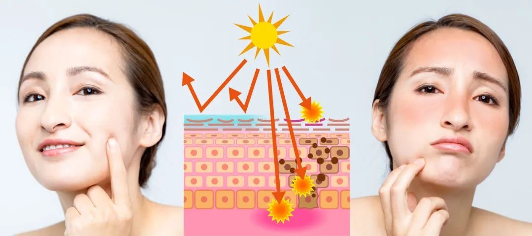 入春脸特别痒,入春皮肤干痒怎么办