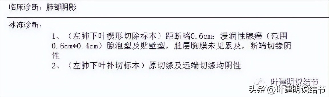 辽宁省肺结节手术哪家医院好,辽宁肺结节手术医院