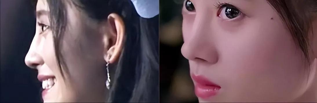 娱乐圈天然脸vs整容脸,娱乐圈没有整容的人纯天然的脸