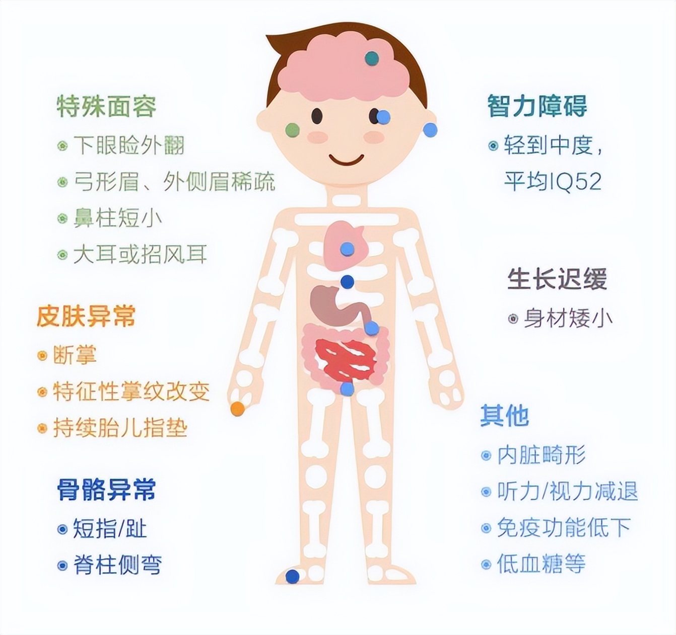 关注罕见病的视频,歌舞伎综合征是什么意思