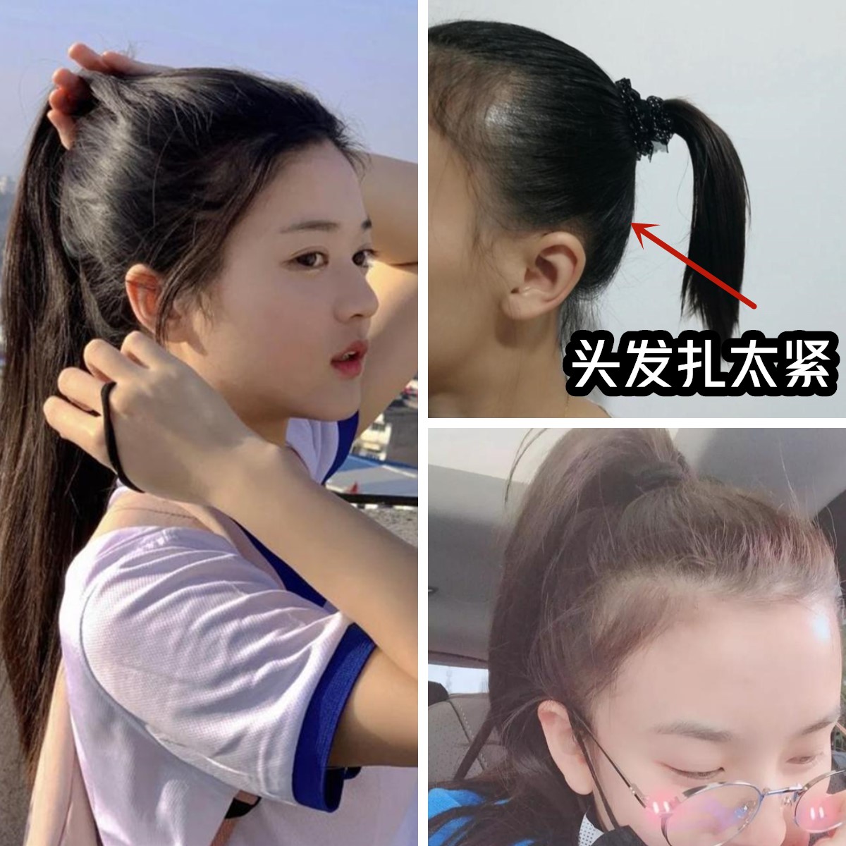 哪些因素会导致秃发,怎样可以停止斑秃继续掉发