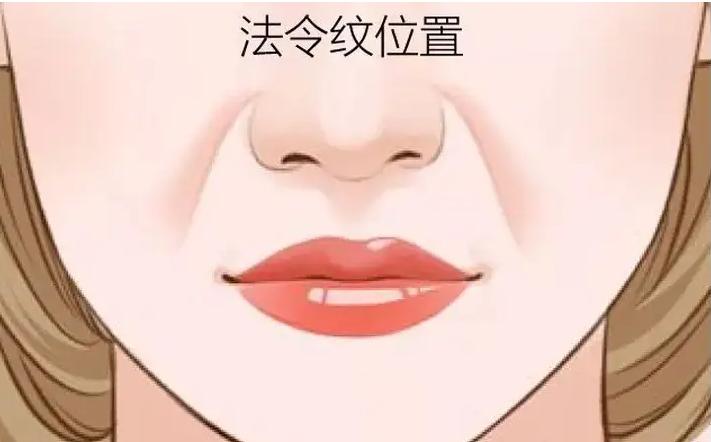 在九院祛法令纹,九院韦敏鼻基底填充与法令纹填充