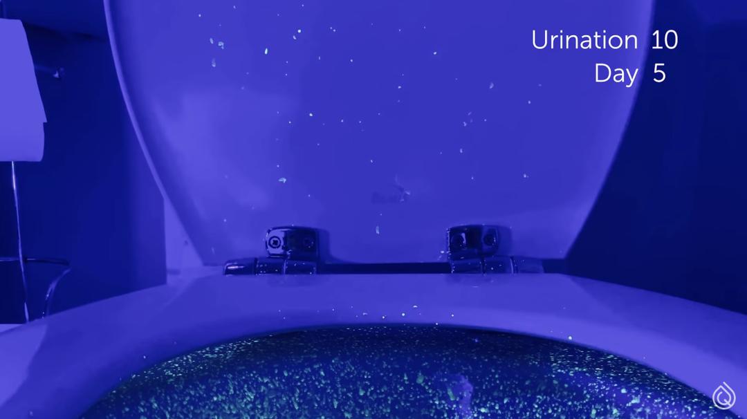 被公厕水溅到会得淋病吗,被公厕水溅到会感染吗