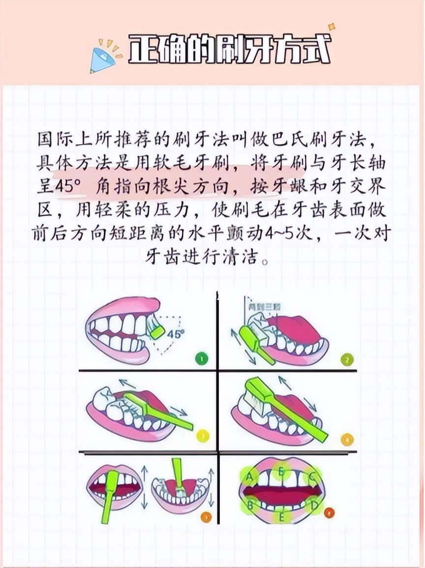 牙周炎治愈指南，这些口腔护理注意事项要牢记