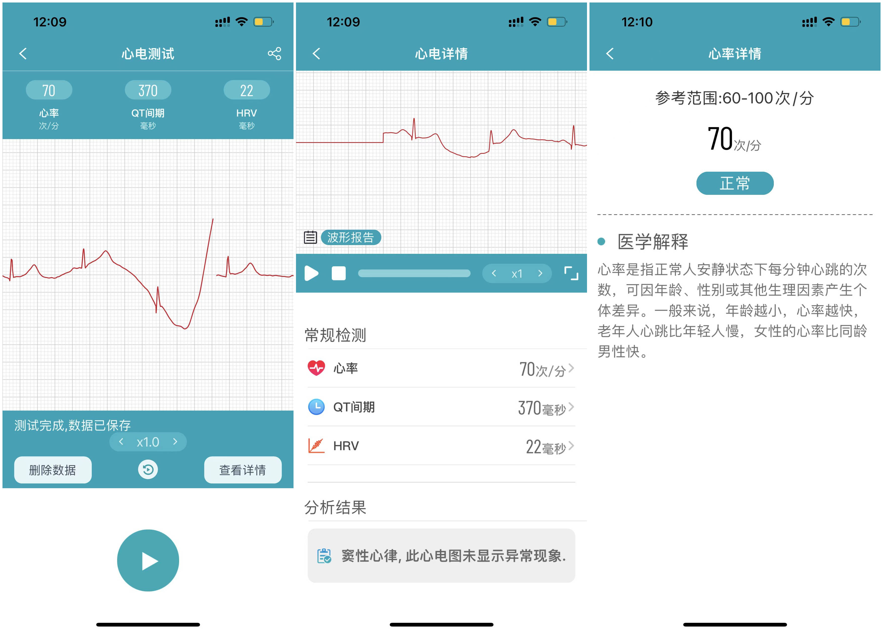 dido智能手环测评,didof51手环测评