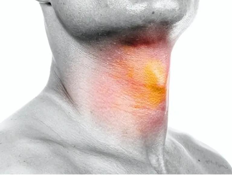 喉癌的症状患者自述,喉癌患者的自述