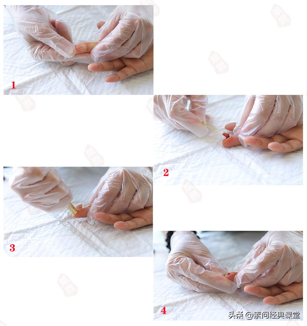 新冠头痛发烧吃什么药最适合,新冠发热头疼中医有什么妙招