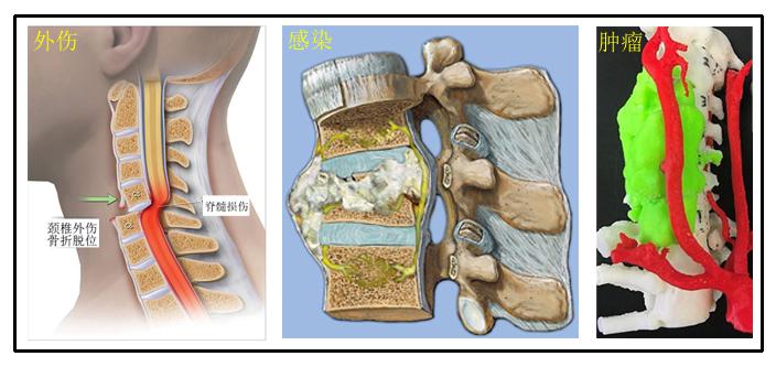 颈痛的最佳治疗方法,最近肩颈疼是什么病毒