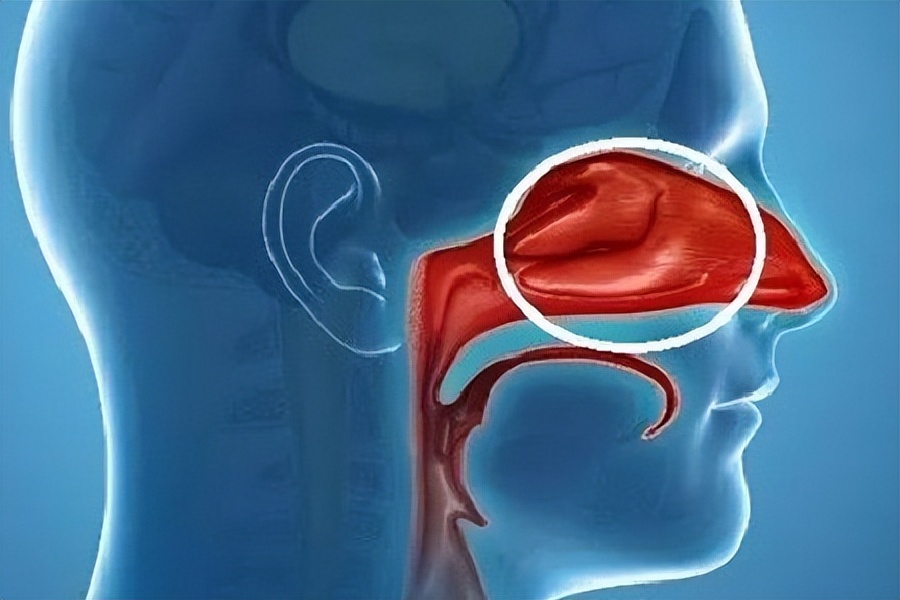 鼻毛窜出来跟什么有关,鼻毛窜出来的原因