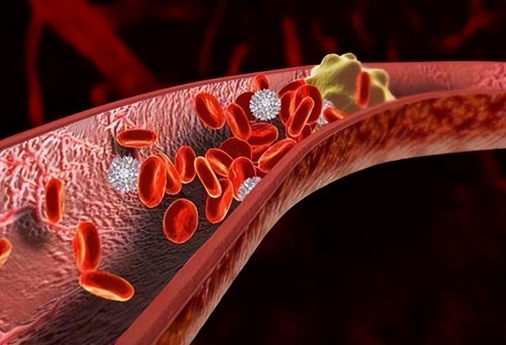 类风湿合并肝病怎么治疗,类风湿合并肾炎怎么治疗