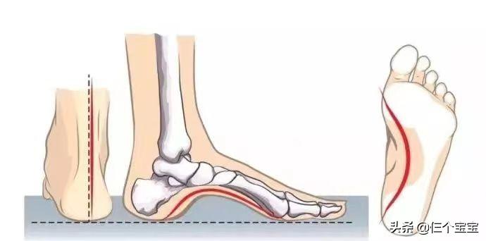 网红踩屎感洞洞鞋防滑,儿童踩屎感椰子鞋