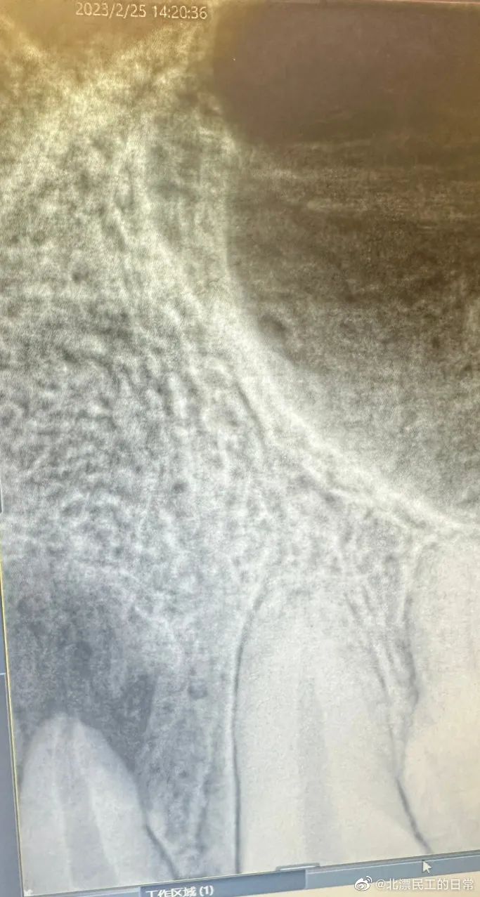 做根管治疗去医院好还是口腔诊所,私立口腔诊所做根管治疗多少钱